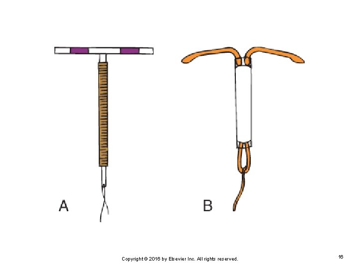 Copyright © 2016 by Elsevier Inc. All rights reserved. 16 