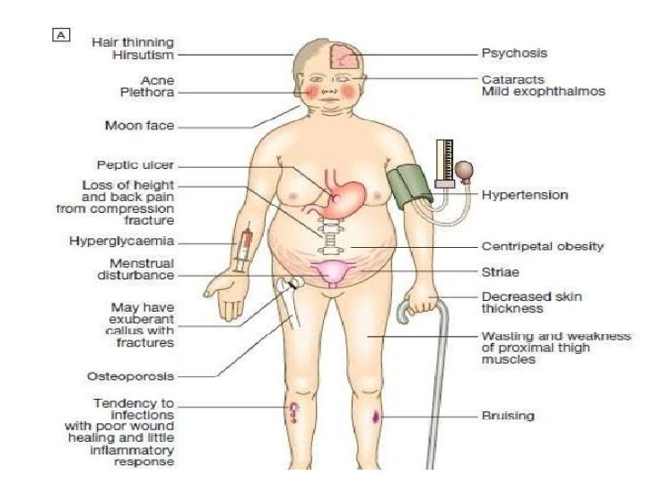 Signs and symptoms 