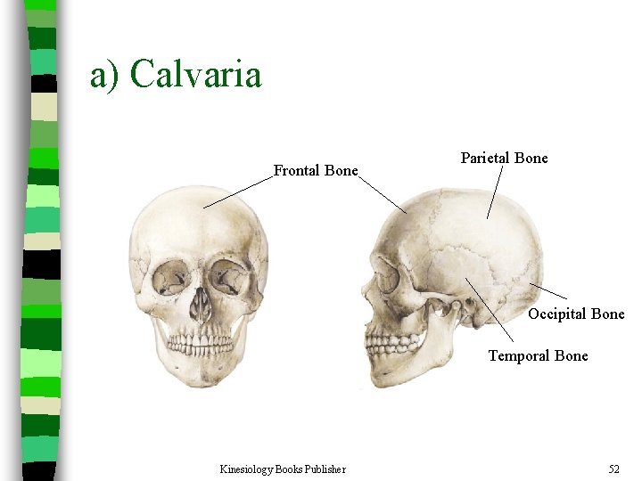 a) Calvaria Frontal Bone Parietal Bone Occipital Bone Temporal Bone Kinesiology Books Publisher 52