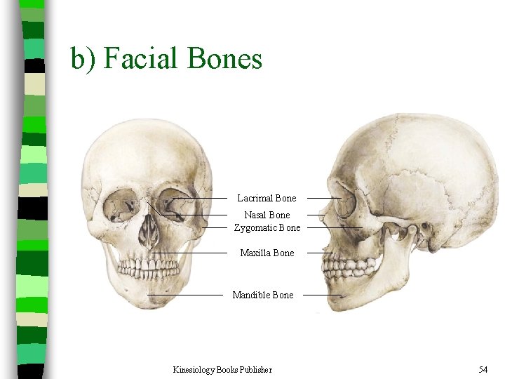 b) Facial Bones Lacrimal Bone Nasal Bone Zygomatic Bone Maxilla Bone Mandible Bone Kinesiology
