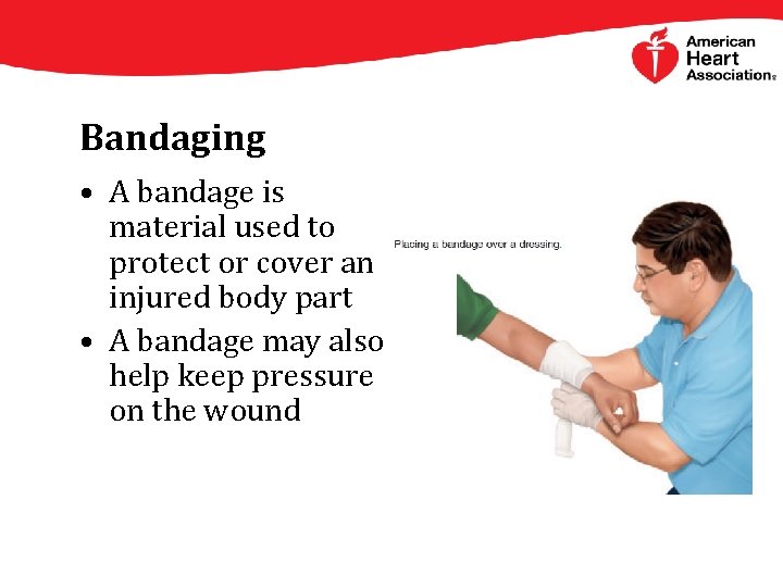 Bandaging • A bandage is material used to protect or cover an injured body
