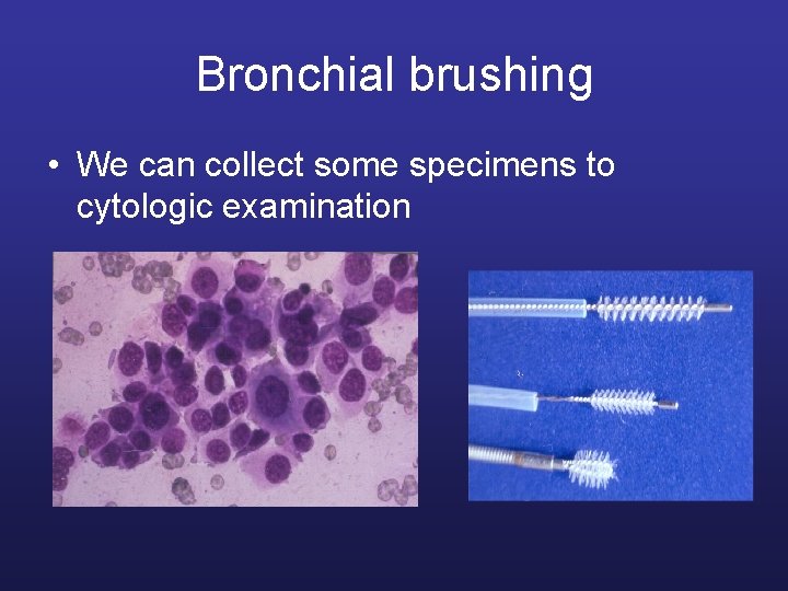Bronchial brushing • We can collect some specimens to cytologic examination 