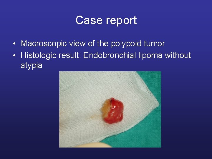 Case report • Macroscopic view of the polypoid tumor • Histologic result: Endobronchial lipoma