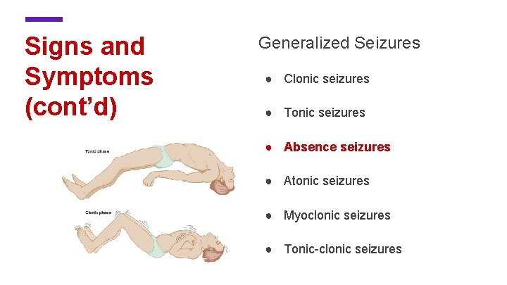 Signs and Symptoms (cont’d) Generalized Seizures ● Clonic seizures ● Tonic seizures ● Absence