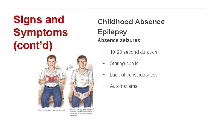Signs and Symptoms (cont’d) Childhood Absence Epilepsy Absence seizures • 10 -20 second duration