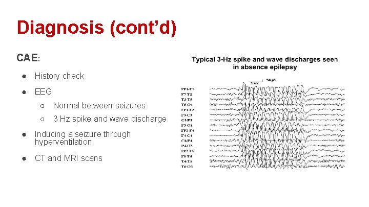 Diagnosis (cont’d) CAE: ● History check ● EEG ○ Normal between seizures ○ 3