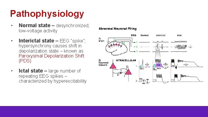 Pathophysiology • Normal state – desynchronized; • Interictal state – EEG “spike”; • Ictal