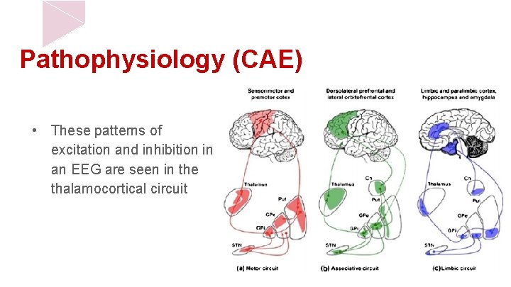 Pathophysiology (CAE) • These patterns of excitation and inhibition in an EEG are seen