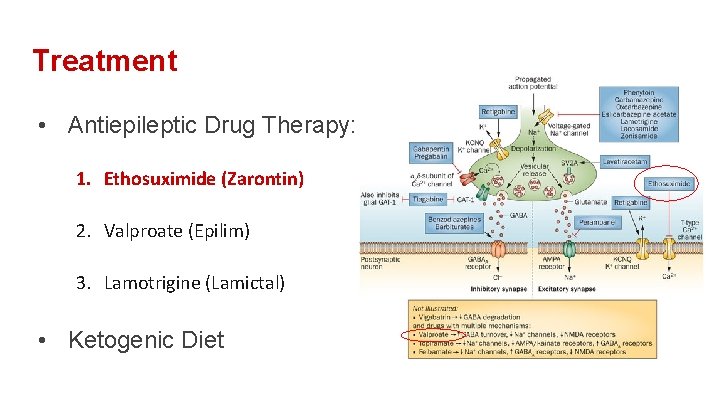 Treatment • Antiepileptic Drug Therapy: 1. Ethosuximide (Zarontin) 2. Valproate (Epilim) 3. Lamotrigine (Lamictal)