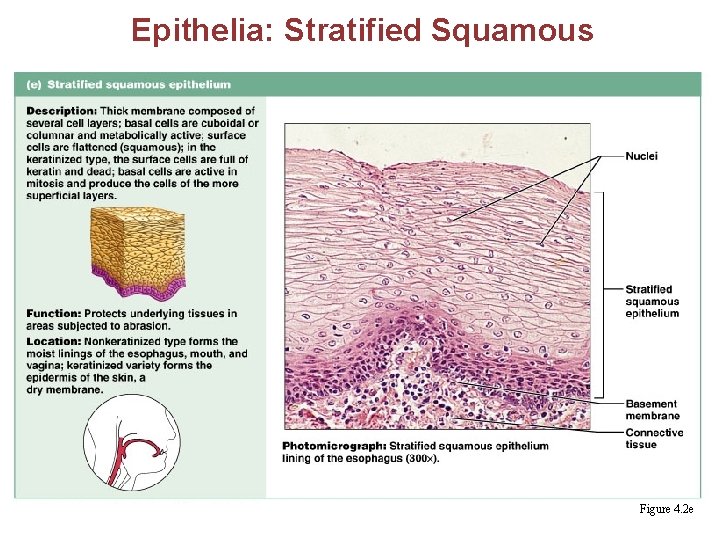 Epithelia: Stratified Squamous § Thick membrane composed of several layers of cells § Function