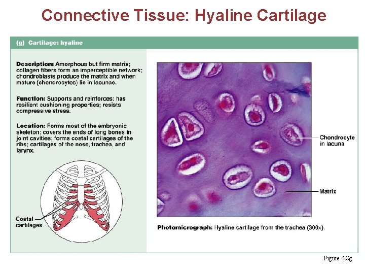 Connective Tissue: Hyaline Cartilage Figure 4. 8 g 