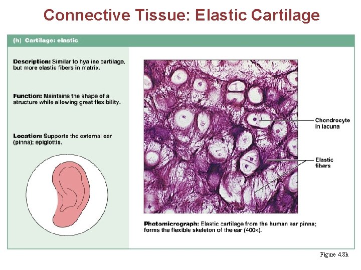 Connective Tissue: Elastic Cartilage § Similar to hyaline cartilage but with more elastic fibers