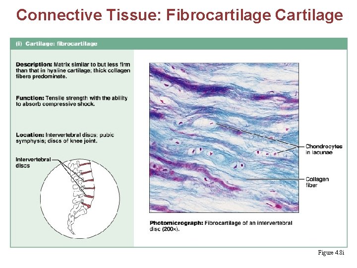 Connective Tissue: Fibrocartilage Cartilage § Matrix similar to hyaline cartilage but less firm with