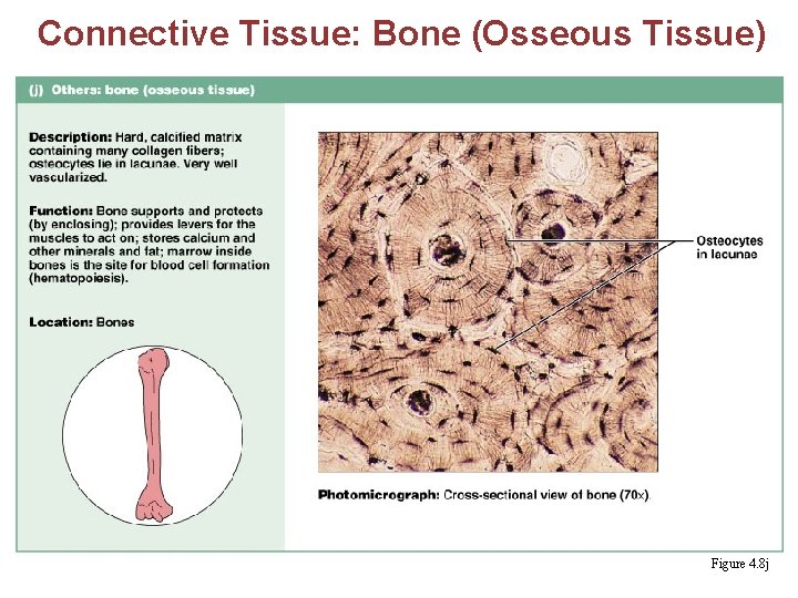 Connective Tissue: Bone (Osseous Tissue) Figure 4. 8 j 