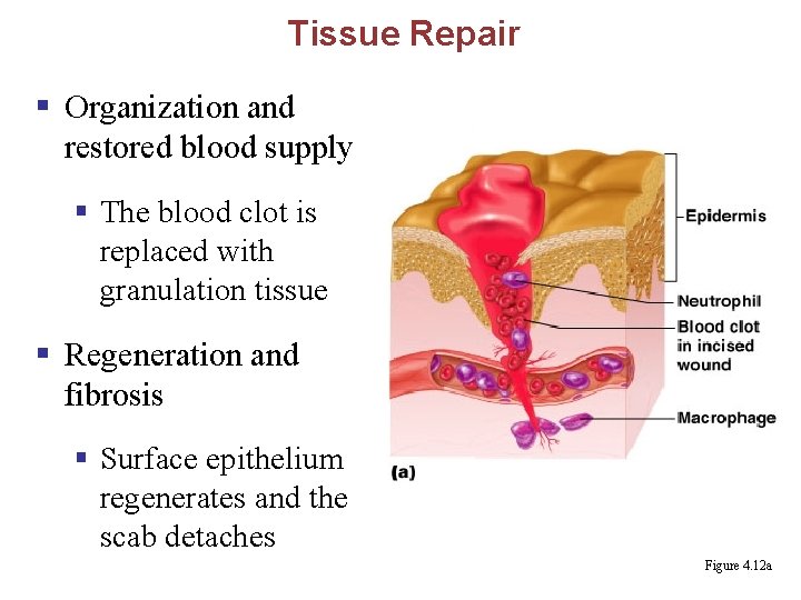 Tissue Repair § Organization and restored blood supply § The blood clot is replaced