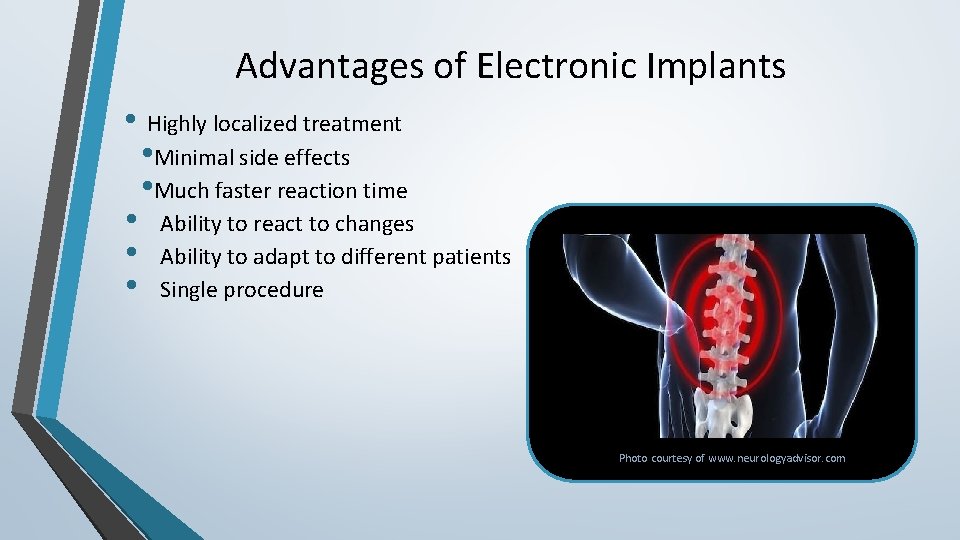 Advantages of Electronic Implants • Highly localized treatment • Minimal side effects • Much