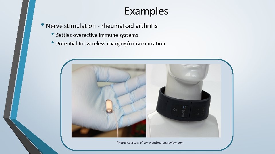 Examples • Nerve stimulation - rheumatoid arthritis • Settles overactive immune systems • Potential