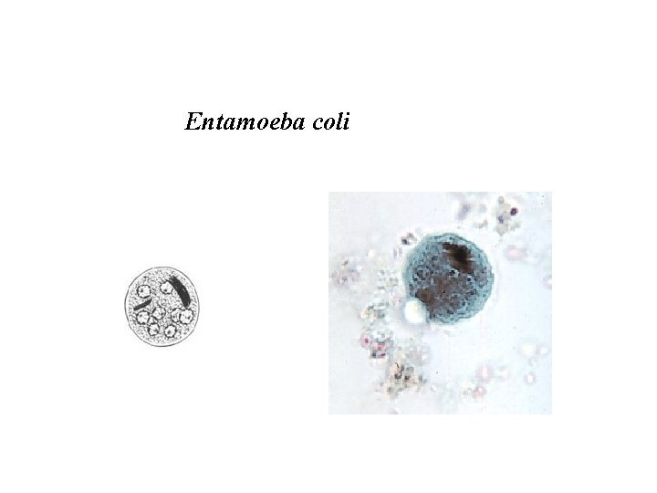 Entamoeba coli 