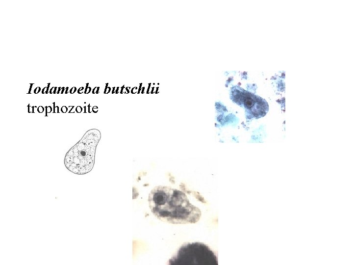 Iodamoeba butschlii trophozoite 