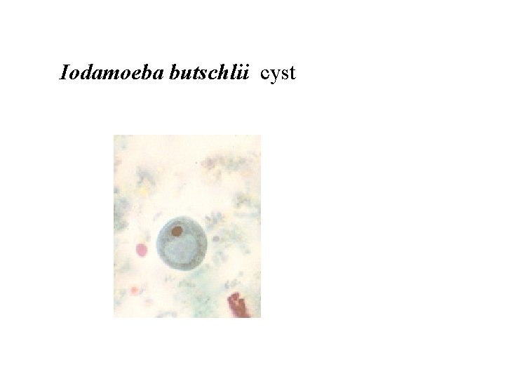 Iodamoeba butschlii cyst 