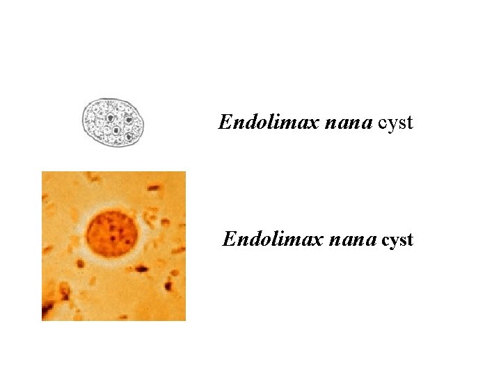 Endolimax nana cyst 