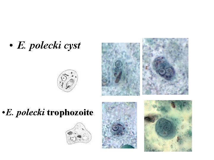  • E. polecki cyst • E. polecki trophozoite 