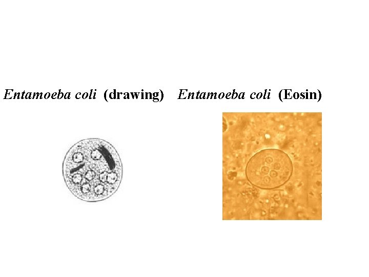 Entamoeba coli (drawing) Entamoeba coli (Eosin) 