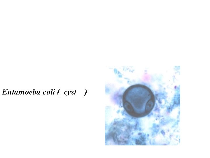 Entamoeba coli ( cyst ) 