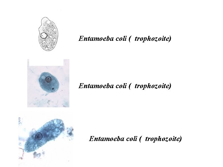 Entamoeba coli ( trophozoite) 