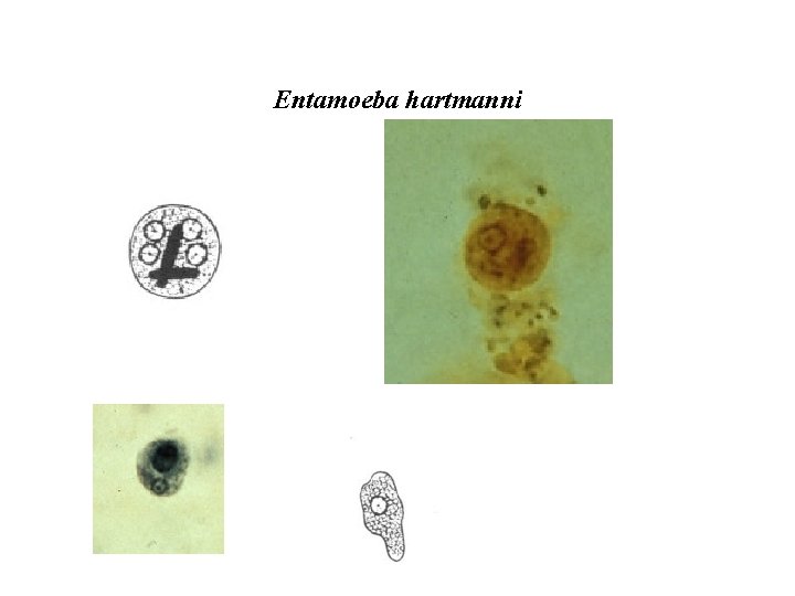Entamoeba hartmanni 
