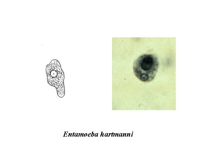Entamoeba hartmanni 
