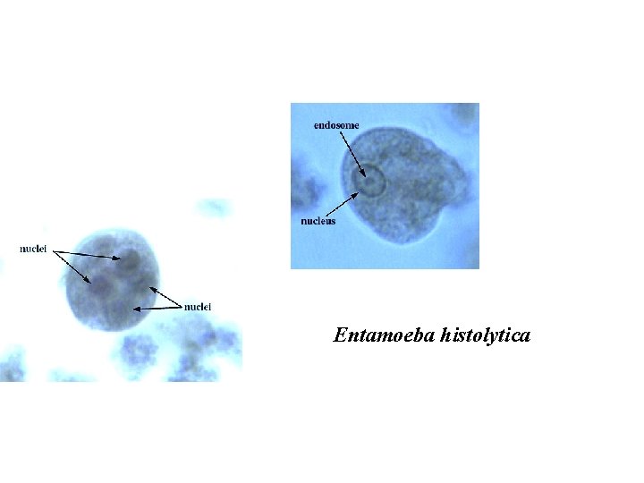 Entamoeba histolytica 