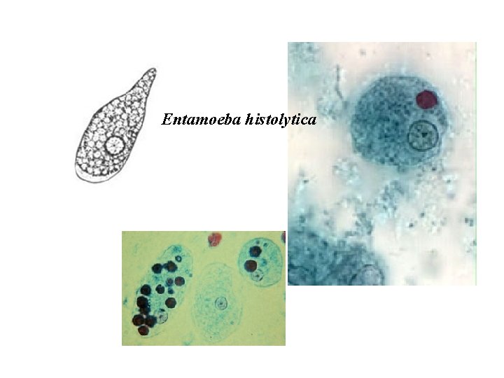 Entamoeba histolytica 