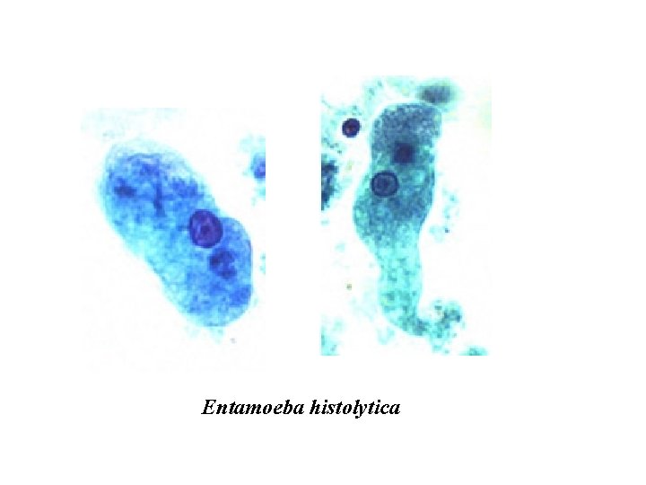 Entamoeba histolytica 