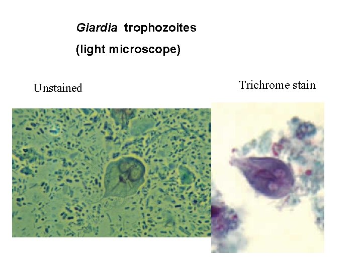 Giardia trophozoites (light microscope) Unstained Trichrome stain 