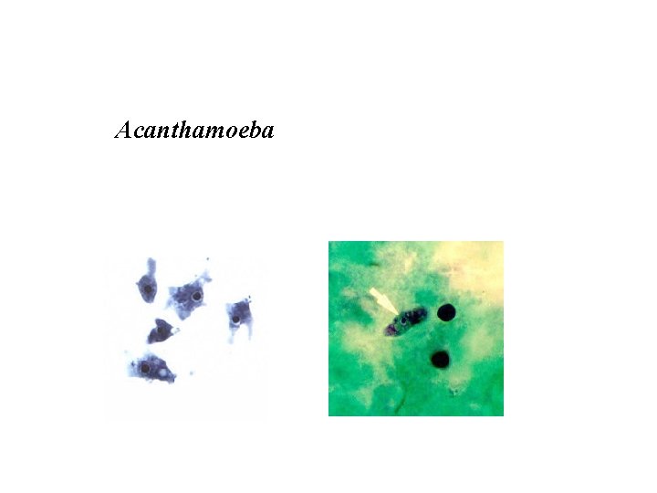 Acanthamoeba 