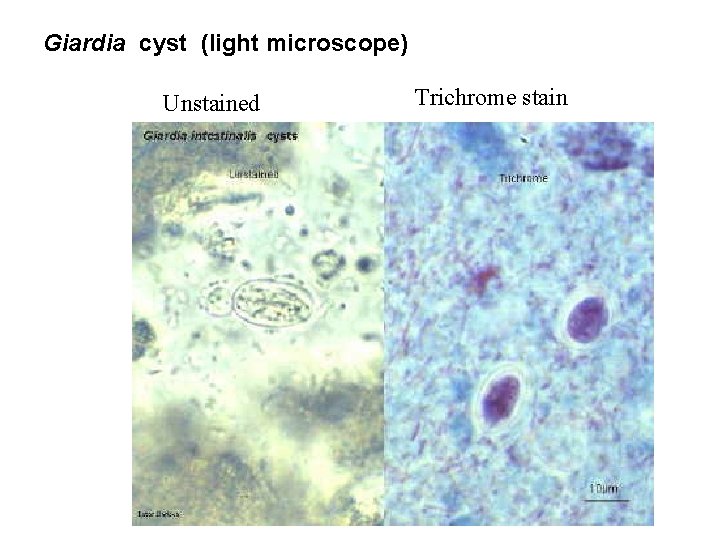 Giardia cyst (light microscope) Unstained Trichrome stain 
