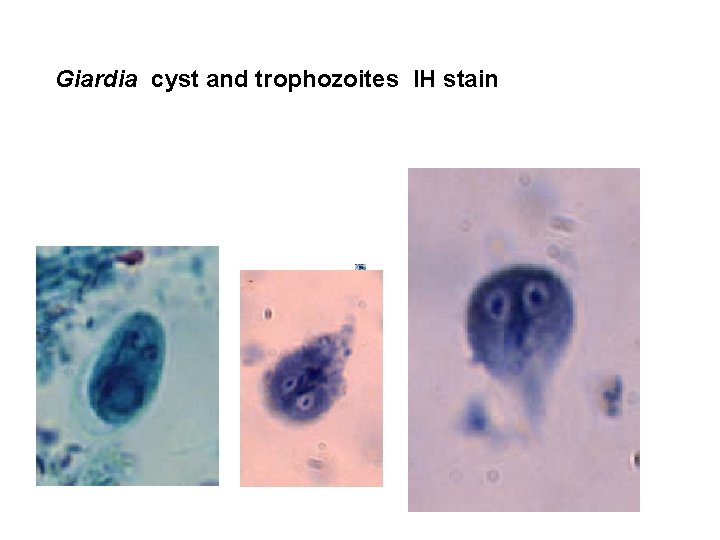 Giardia cyst and trophozoites IH stain 