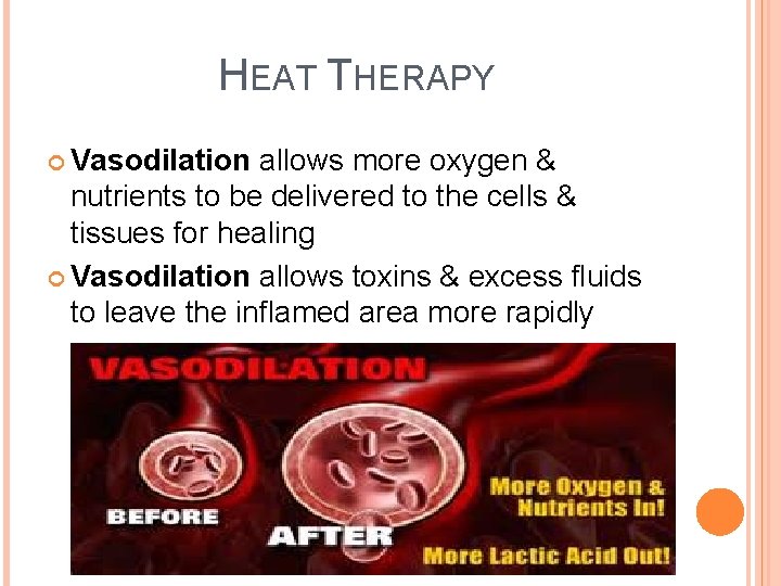 REHAB PROCEDURES HEAT THERAPY VS COLD THERAPY HEAT