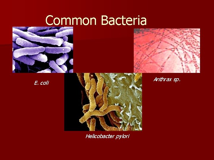 Common Bacteria Anthrax sp. E. coli Helicobacter pylori 
