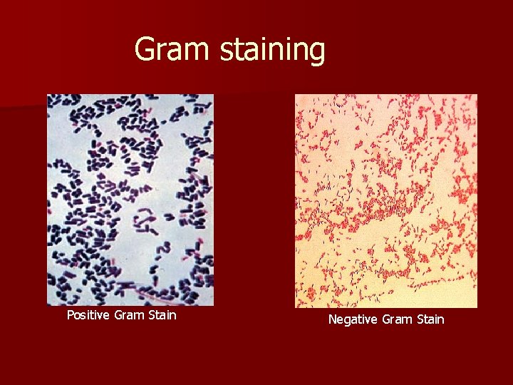Gram staining Positive Gram Stain Negative Gram Stain 