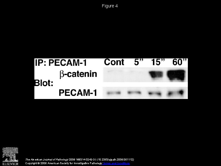 Figure 4 The American Journal of Pathology 2006 169314 -324 DOI: (10. 2353/ajpath. 2006.