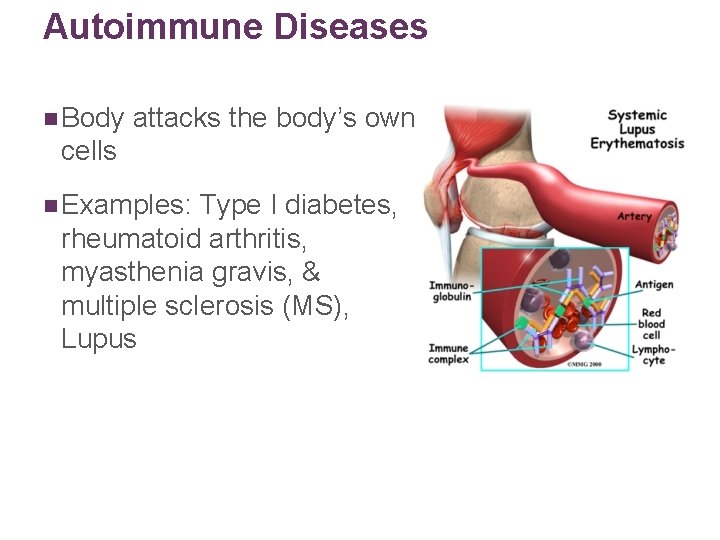 Autoimmune Diseases n Body attacks the body’s own cells n Examples: Type I diabetes,