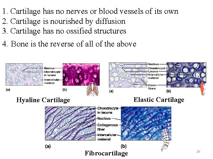 1. Cartilage has no nerves or blood vessels of its own 2. Cartilage is
