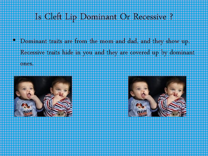 Is Cleft Lip Dominant Or Recessive ? • Dominant traits are from the mom