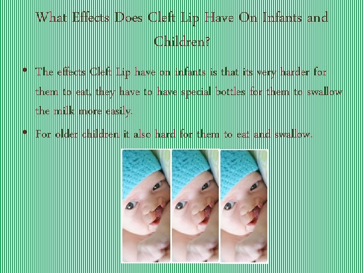 What Effects Does Cleft Lip Have On Infants and Children? • The effects Cleft