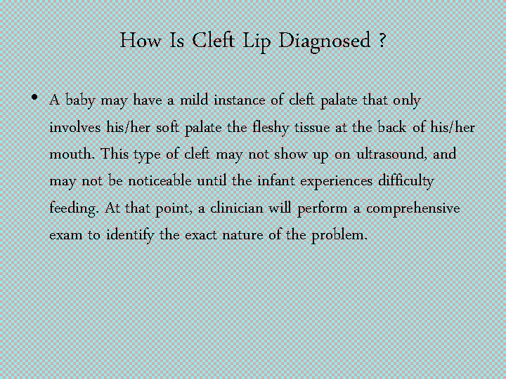 How Is Cleft Lip Diagnosed ? • A baby may have a mild instance