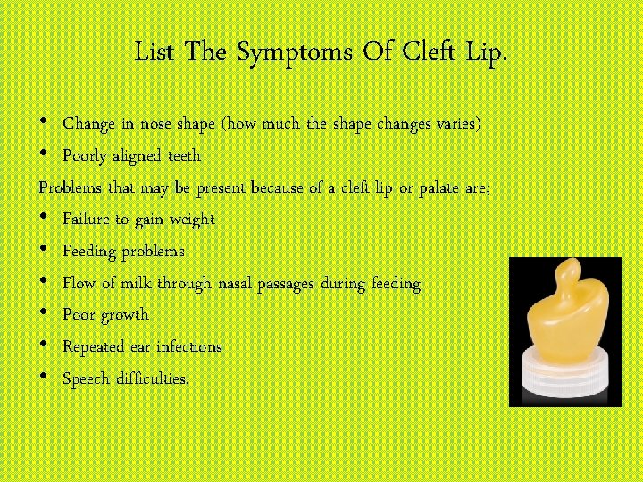 List The Symptoms Of Cleft Lip. • Change in nose shape (how much the