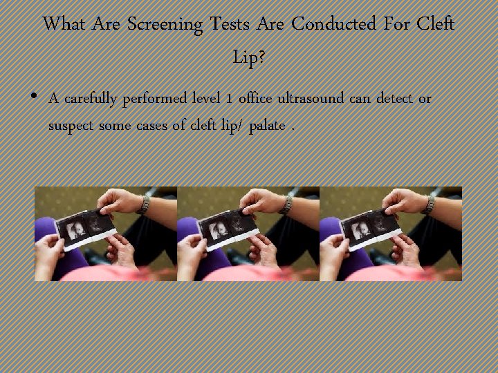 What Are Screening Tests Are Conducted For Cleft Lip? • A carefully performed level