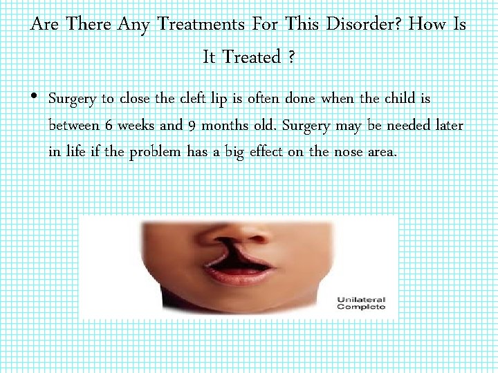 Are There Any Treatments For This Disorder? How Is It Treated ? • Surgery